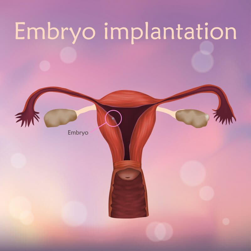 Hnízdění nebo implantace embryí - definice, koncept a co to je